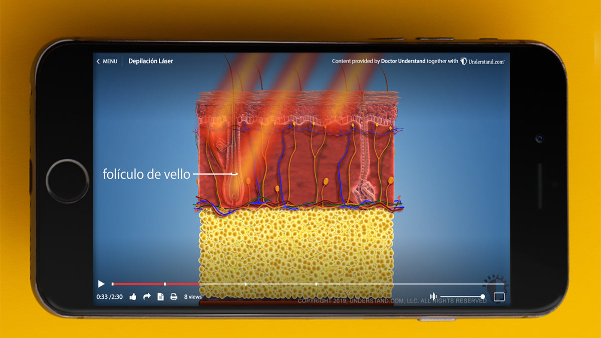 Updated HD Laser Hair Removal Animation Now Available in Spanish and P