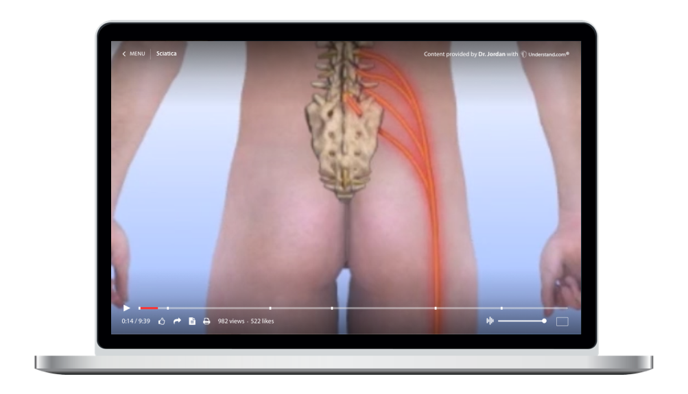 laptop showing a customized Sciatica Animation