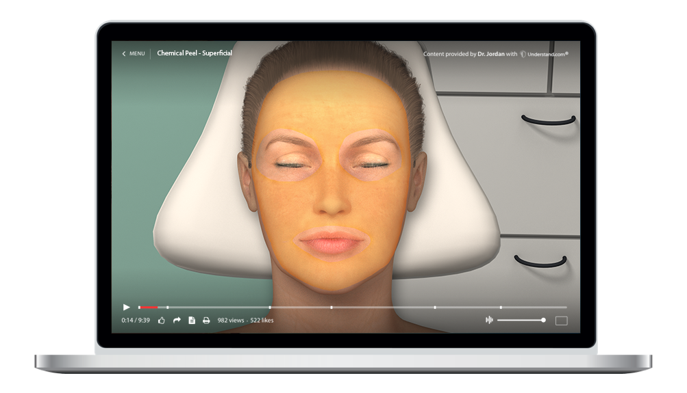 laptop showing a customized Chemical Peel - Superficial Animation