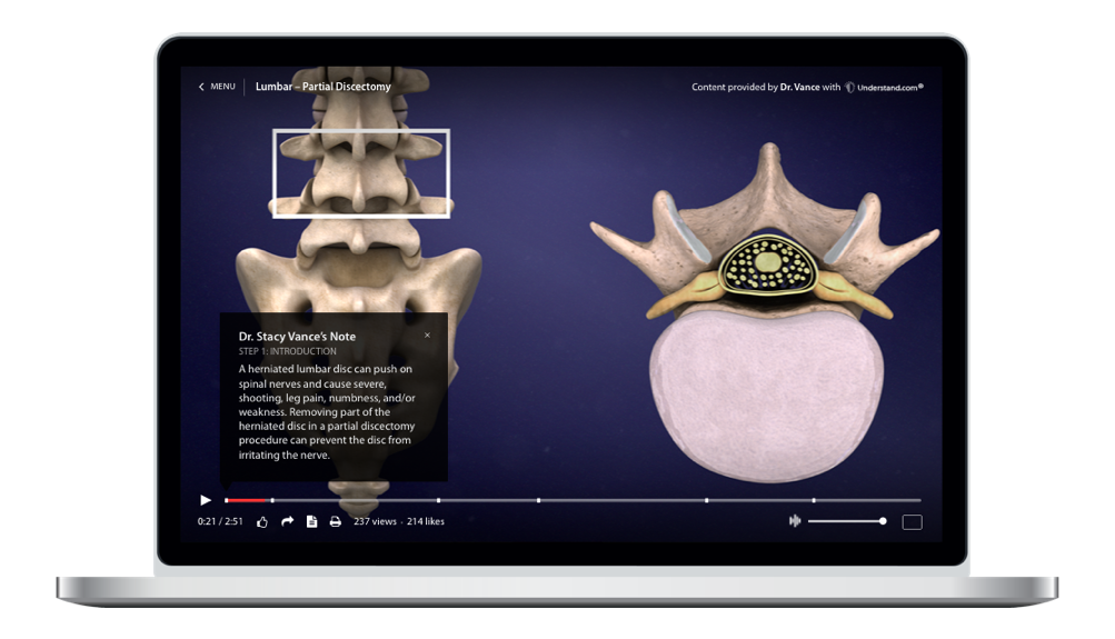 laptop showing a customized Spine Animation Library
