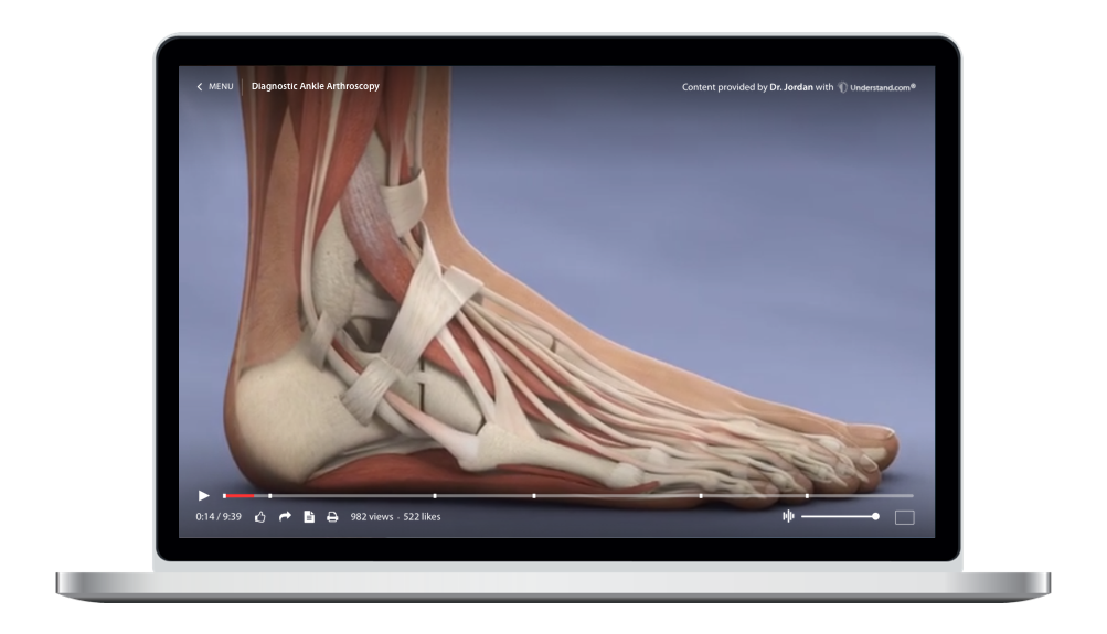 Diagnostic Ankle Arthroscopy Animation