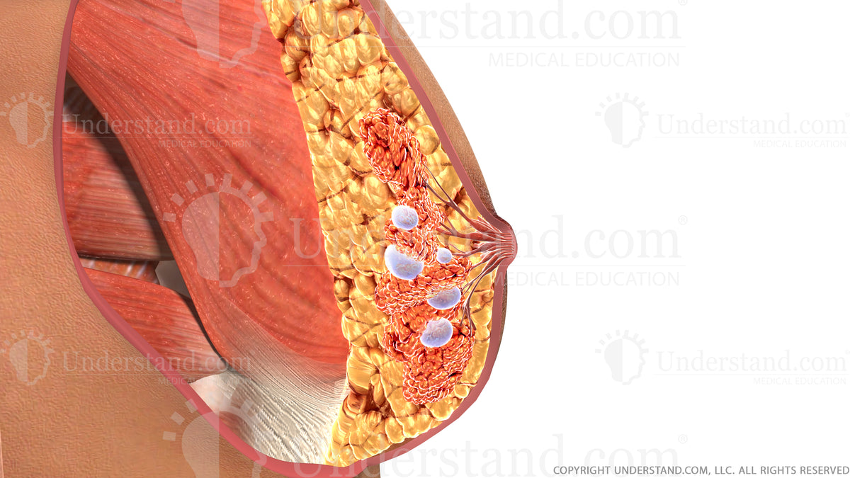 types of cysts in breast tissue
