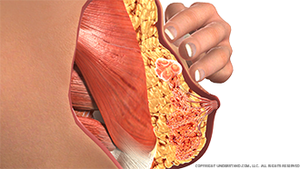 breast-self-exam-medium-pressure