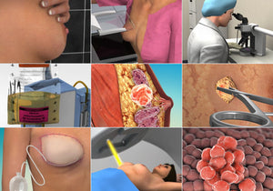 Breast Cancer Animation Library