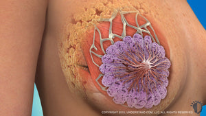 Breast Reduction Animation Addition to the Plastic Surgery animation library