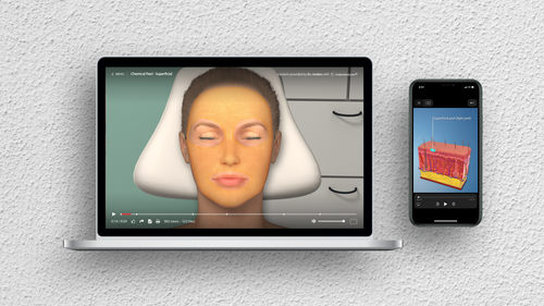 Chemical Peel - Superficial Animation on Laptop and iPhone