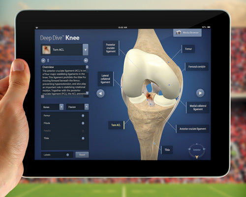 The Deep Dives™ 3D Web App Provides Unprecedented Orthopedic Education for Patients and Healthcare Professionals