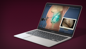 Updated HD Diagnostic Hip Arthroscopy animation now available in the Understand.com® Orthopaedic Library