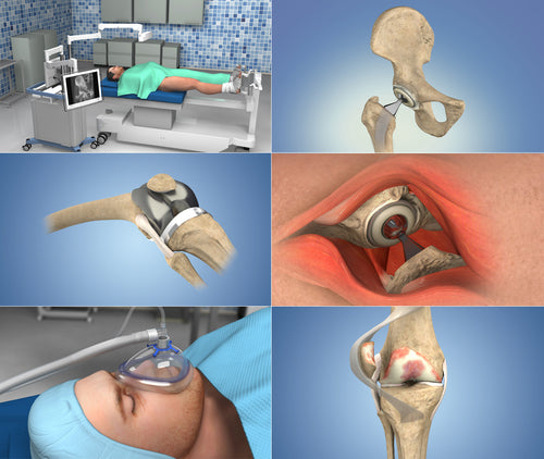 expanded orthopaedic animation library