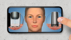 Understand.com® continues to update Plastic Surgery and Dermatology Libraries with the release of the updated HD Microdermabrasion animation