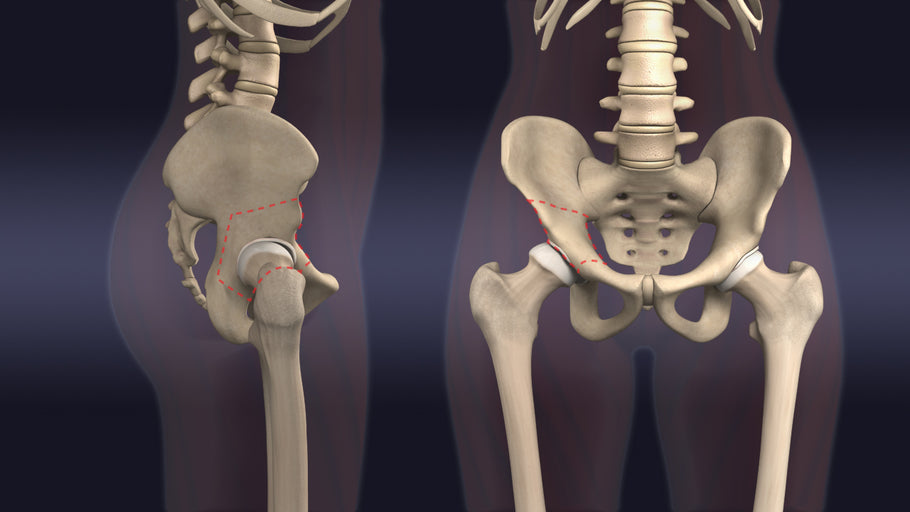 Understand.com® is excited to announce the release of our updated Periacetabular Osteotomy (PAO) animation