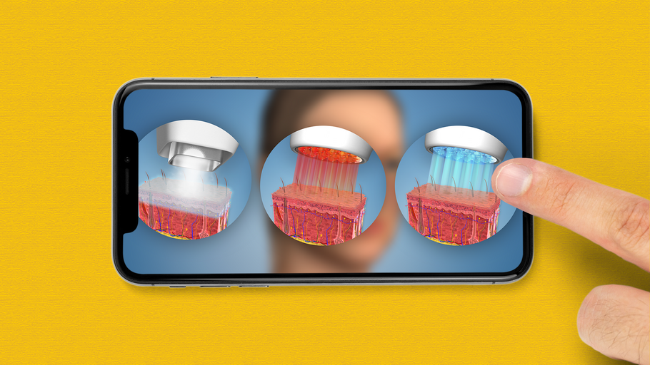 New Photofacial animation added to Plastic Surgery and Dermatology libraries