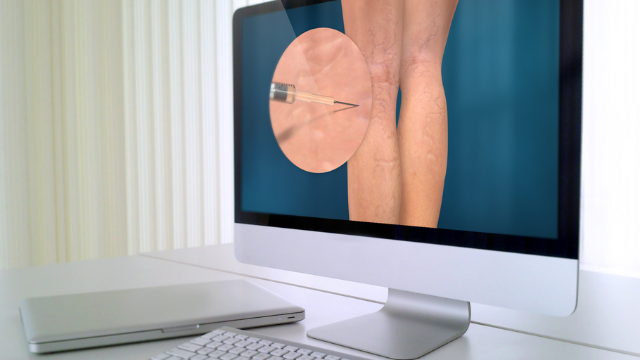 All-new CoolSculpting animation now available in the Plastic Surgery Library