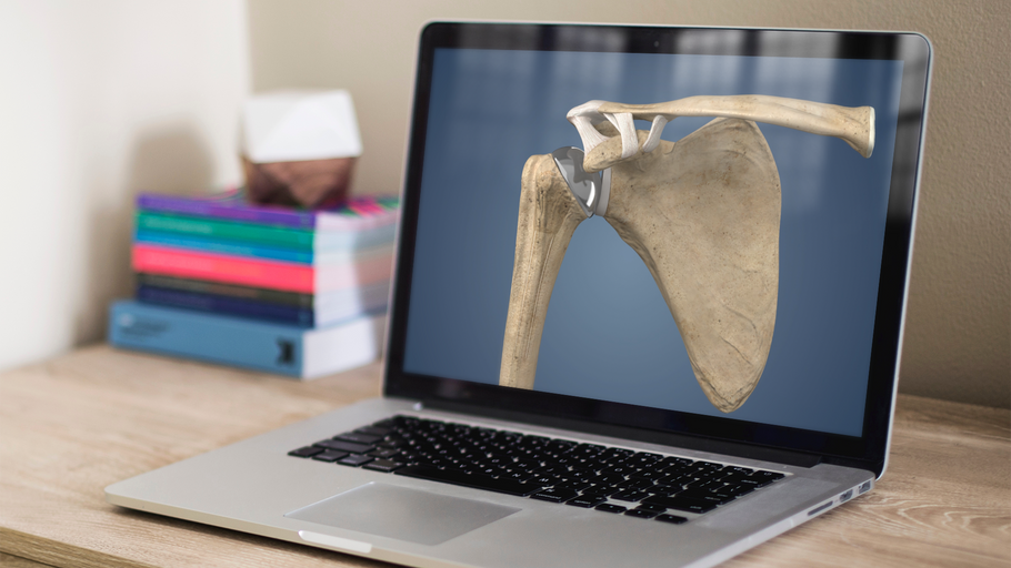 Understand.com<sup>®</sup> releases the latest HD update to our Orthopaedic Library: The Torn ACL Reconstruction - Quadriceps Tendon Graft animation