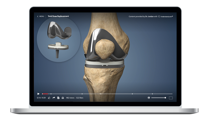 Total Knee Replacement Animation
