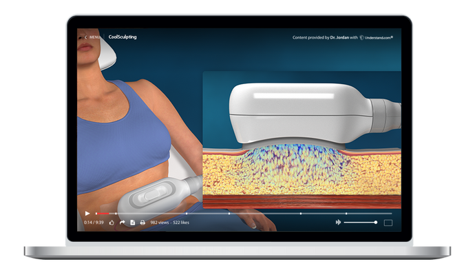 CoolSculpting