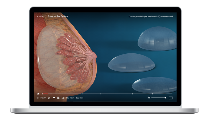 Breast Implant Options Animation