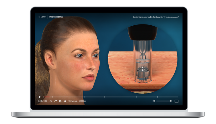 Microneedling