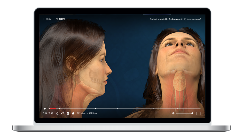 laptop showing a customized Neck Lift