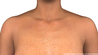 Decolletage Female Anterior Image