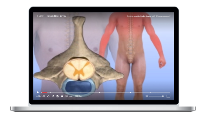 Herniated Disc - Cervical Animation