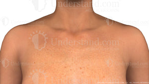 Decolletage Female Anterior Image