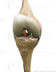 Torn ACL Anterior Flexed Image