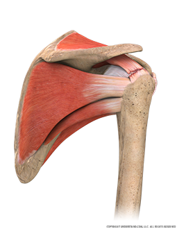 Fully Torn Rotator Cuff Posterior Three Quarter Image