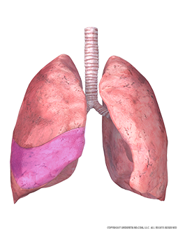 Lungs and Trachea with Middle Right Lobe Highlighted Image