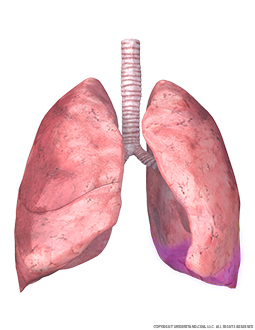 Lungs and Trachea with Inferior Left Lobe Highlighted Image
