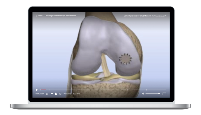 Autologous Chondrocyte Implantation Animation