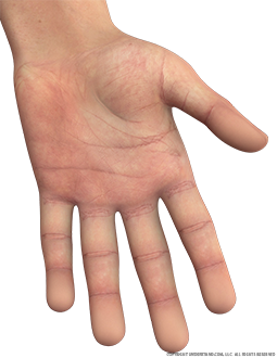 Hand Male Left Palmar Image