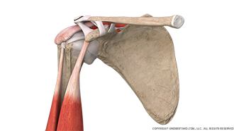 Shoulder Bursitis Anterior Image