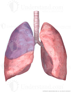 Lungs and Trachea with Superior Right Lobe Highlighted Image