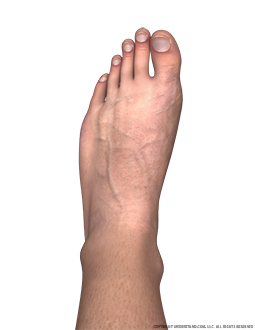 Foot Male Left Dorsal Image