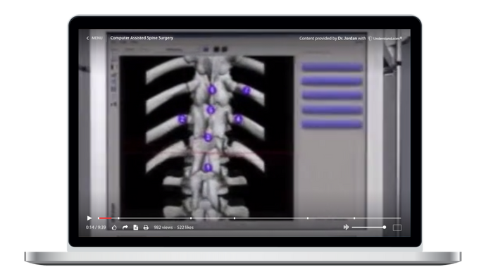Computer-Assisted Spine Surgery Animation