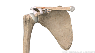 Clavicular Fracture Anterior Image