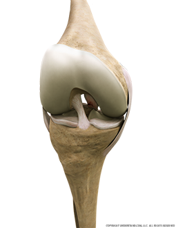 Torn PCL Anterior Flexed Image