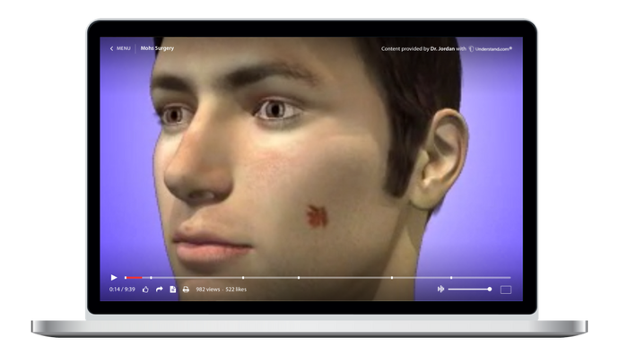 Mohs Surgery Animation