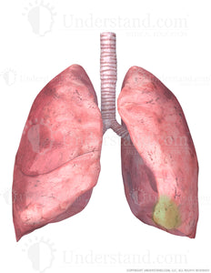 Lungs and Trachea with Lingula Highlighted Image
