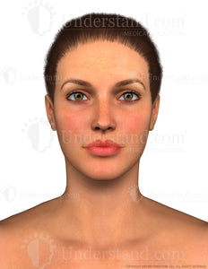 Face Female Anterior Image