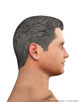 Face Male Right Lateral Image