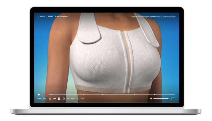 Breast Lift with Implants Animation