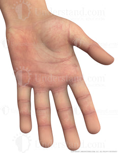 Hand Male Left Palmar Image