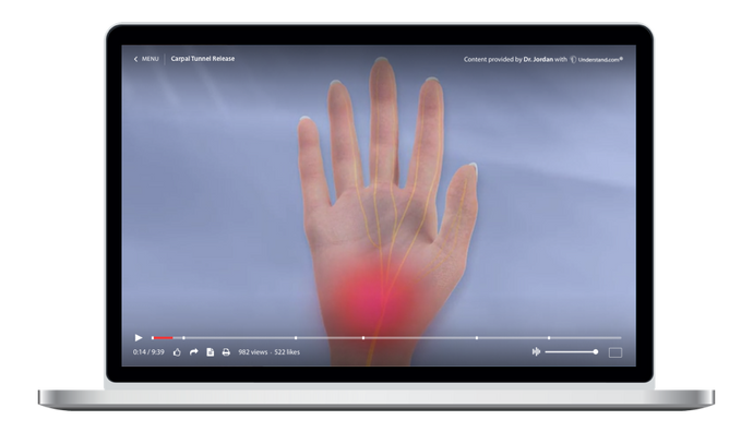 Carpal Tunnel Release Animation