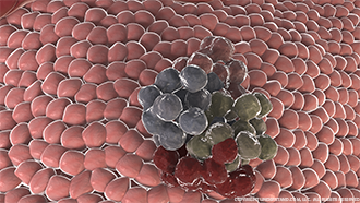 Cancer Cells Image