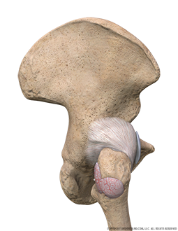 Hip Bursitis Lateral Image