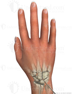 Wrist Arthroscopy Image