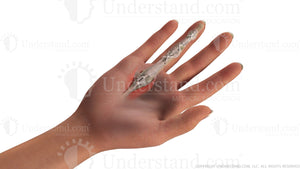 Trigger Finger Release Image