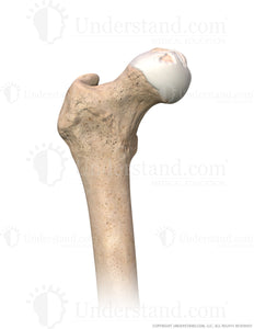 Hip Osteonecrosis Anterior Image